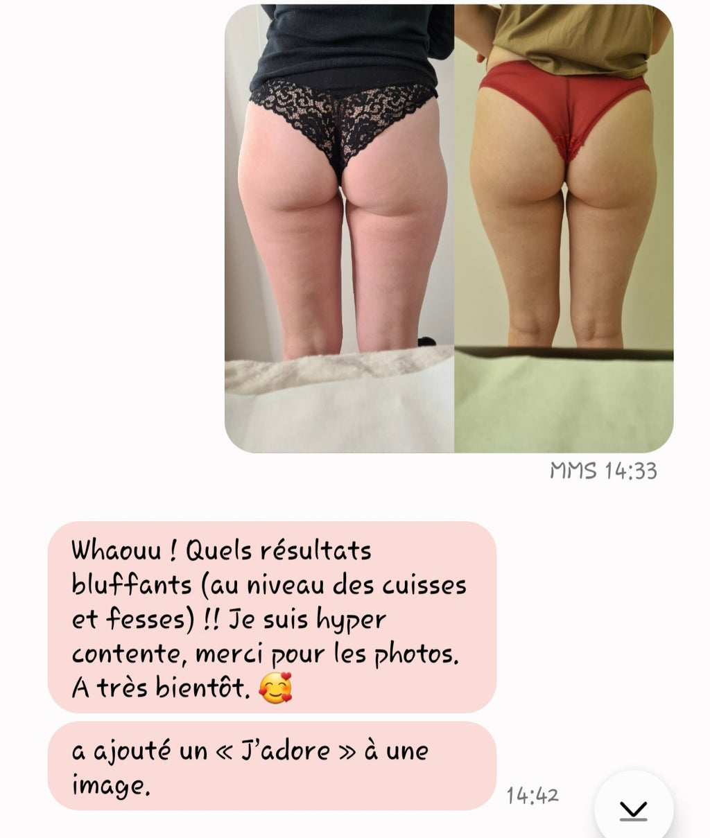 Remodelage Méthode Renata França - Massage Remodelant du Corps