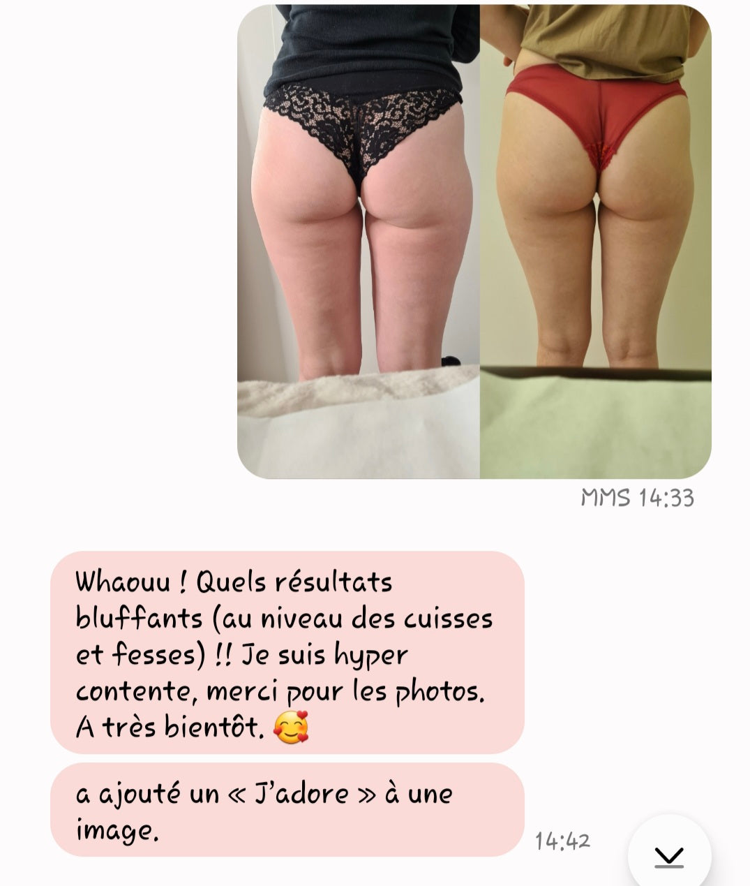 Remodelage Méthode Renata França - Massage Remodelant du Corps
